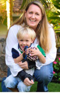 Judi Riley shortly after the crush injury that led to her CRPS RSD