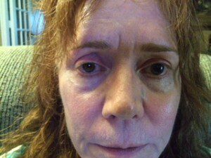 Terri Arnett writes about how CRPS/RSD can take away all of your positivity, but how you can find hope and encouragement through the process.