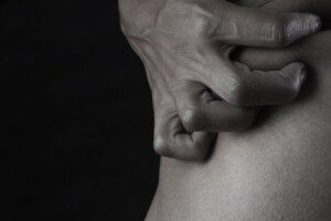 Arthritis CRPS