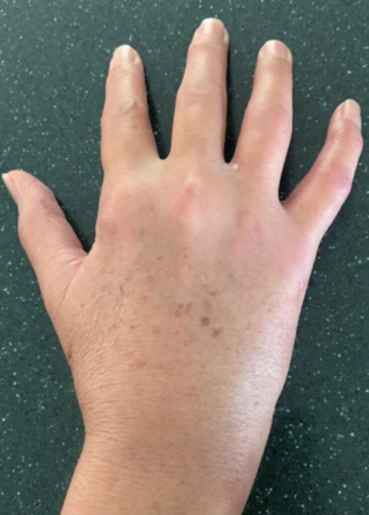 Teryl Worster Hand